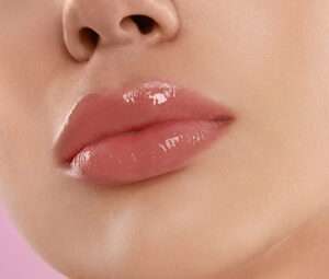 Lip Fillers